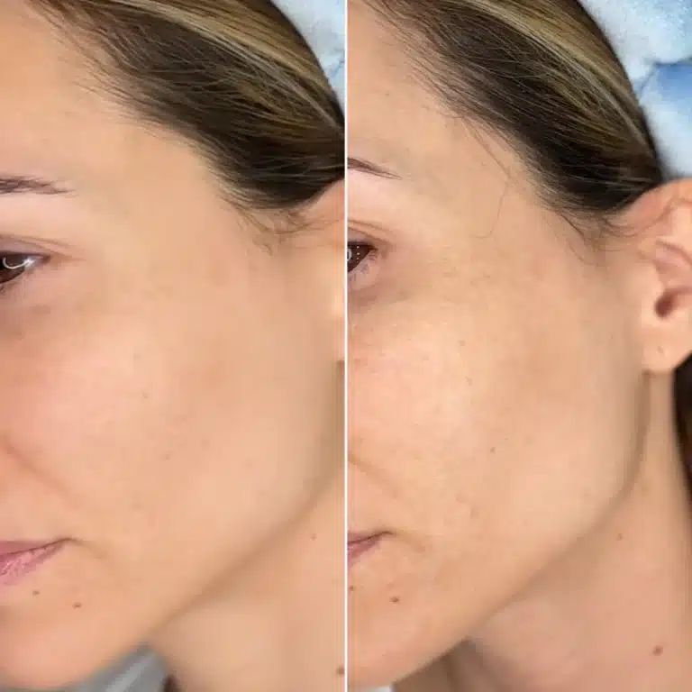 Mascarilla Clarins Cryo-Flash Cream-Mask. Review y opinión: piel radiante, reduce la inflamación, cierra poros, estimula la circulación.